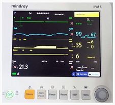 Anaesthetic monitoring equipment